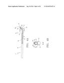 Dialysis Catheters with Fluoropolymer Additives diagram and image