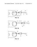 METHOD OF TREATING INFECTIONS, DISEASES OR DISORDERS OF NAIL UNIT diagram and image