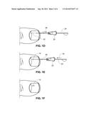 METHOD OF TREATING INFECTIONS, DISEASES OR DISORDERS OF NAIL UNIT diagram and image