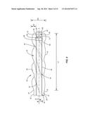 DEVICE FOR PERFORMING A SURGICAL PROCEDURE AND METHOD diagram and image