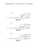 Boosting Catheter and Related Systems and Methods diagram and image