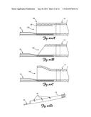 Boosting Catheter and Related Systems and Methods diagram and image