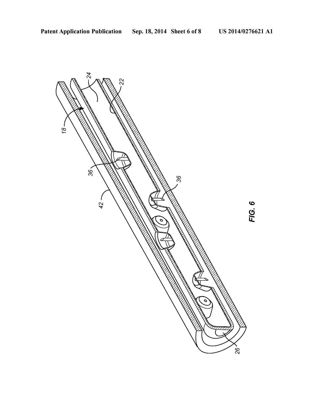 FLUID DELIVERY CATHETER WITH PRESSURE-ACTUATING NEEDLE DEPLOYMENT AND     RETRACTION - diagram, schematic, and image 07