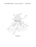 TREATMENT OF TISSUE diagram and image