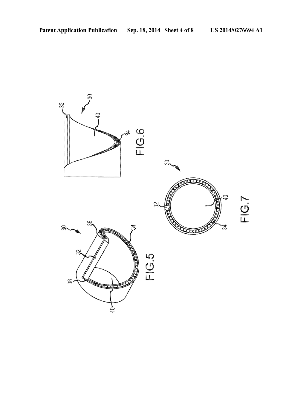 Device and Method of Ablative Cutting with Helical Tip - diagram, schematic, and image 05