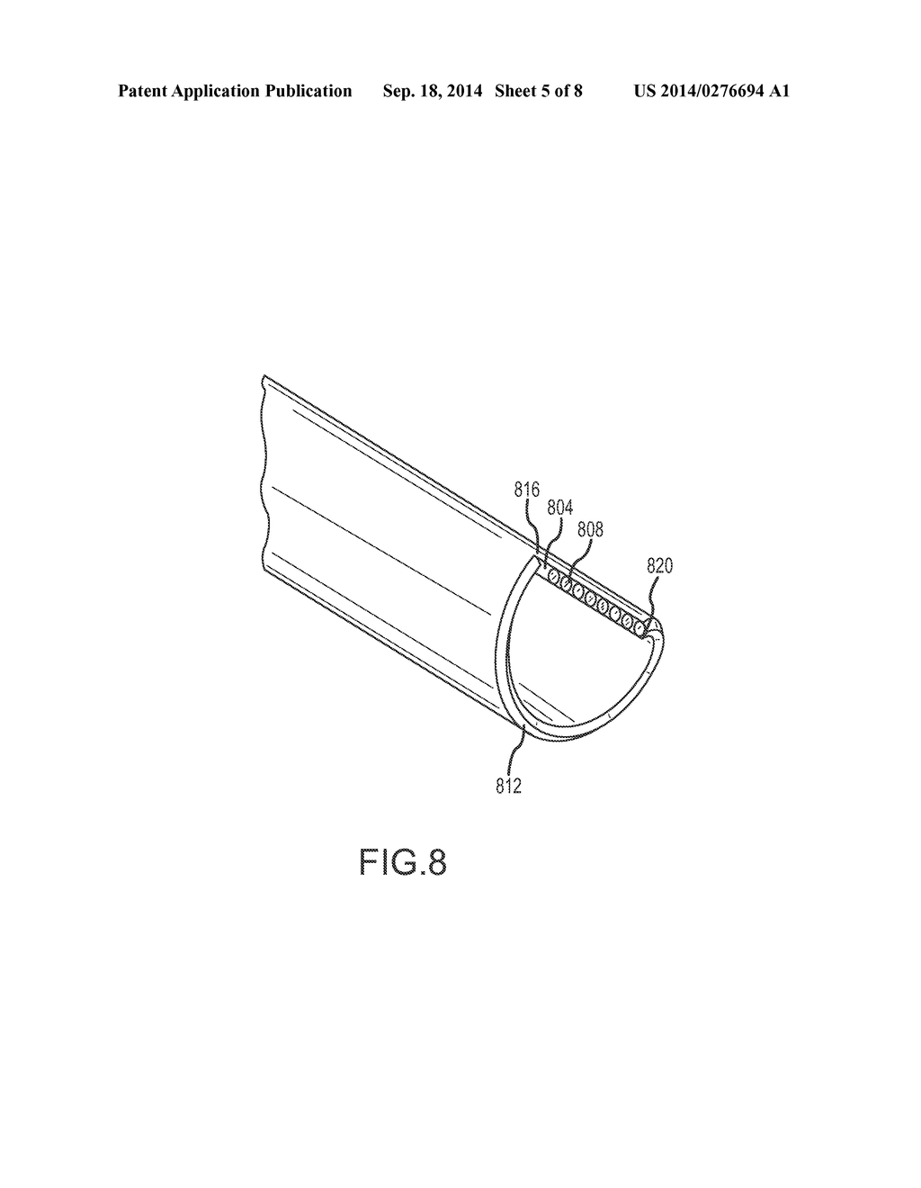 Device and Method of Ablative Cutting with Helical Tip - diagram, schematic, and image 06