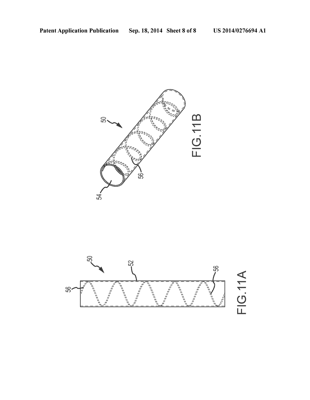 Device and Method of Ablative Cutting with Helical Tip - diagram, schematic, and image 09