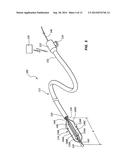 FEEDBACK SYSTEMS AND METHODS UTILIZING TWO OR MORE SITES ALONG DENERVATION     CATHETER diagram and image