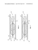 FEEDBACK SYSTEMS AND METHODS UTILIZING TWO OR MORE SITES ALONG DENERVATION     CATHETER diagram and image