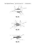 OFFSET FORCEPS diagram and image