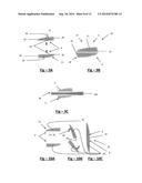 OFFSET FORCEPS diagram and image