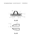 OFFSET FORCEPS diagram and image