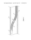 DEFLECTABLE MEDICAL DEVICES diagram and image