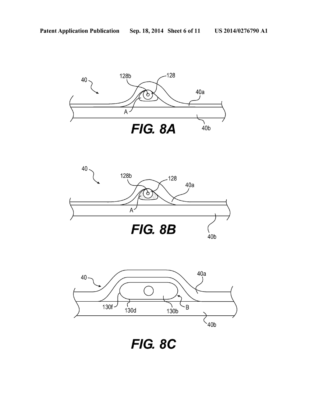 DEVICES FOR TISSUE SEPARATION AND RELATED METHODS OF USE - diagram, schematic, and image 07