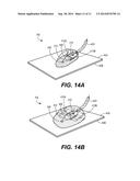 DEVICES FOR TISSUE SEPARATION AND RELATED METHODS OF USE diagram and image