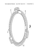 External Bone Fixation Device diagram and image