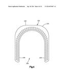 External Bone Fixation Device diagram and image