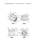 External Bone Fixation Device diagram and image