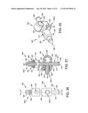 EXTERNAL FIXATION diagram and image