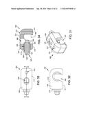 EXTERNAL FIXATION diagram and image