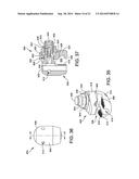 EXTERNAL FIXATION diagram and image