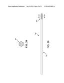 EXTERNAL FIXATION diagram and image