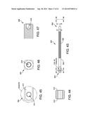 EXTERNAL FIXATION diagram and image