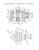 EXTERNAL FIXATION diagram and image