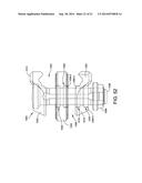 EXTERNAL FIXATION diagram and image