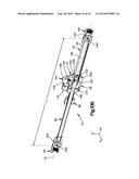 External Bone Fixation Device diagram and image