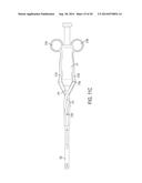 METHODS AND DEVICES FOR REMOVING A SPINAL DISC diagram and image