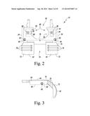 FEMORAL ORTHOPAEDIC INSTRUMENT ASSEMBLY FOR SETTING OFFSET diagram and image