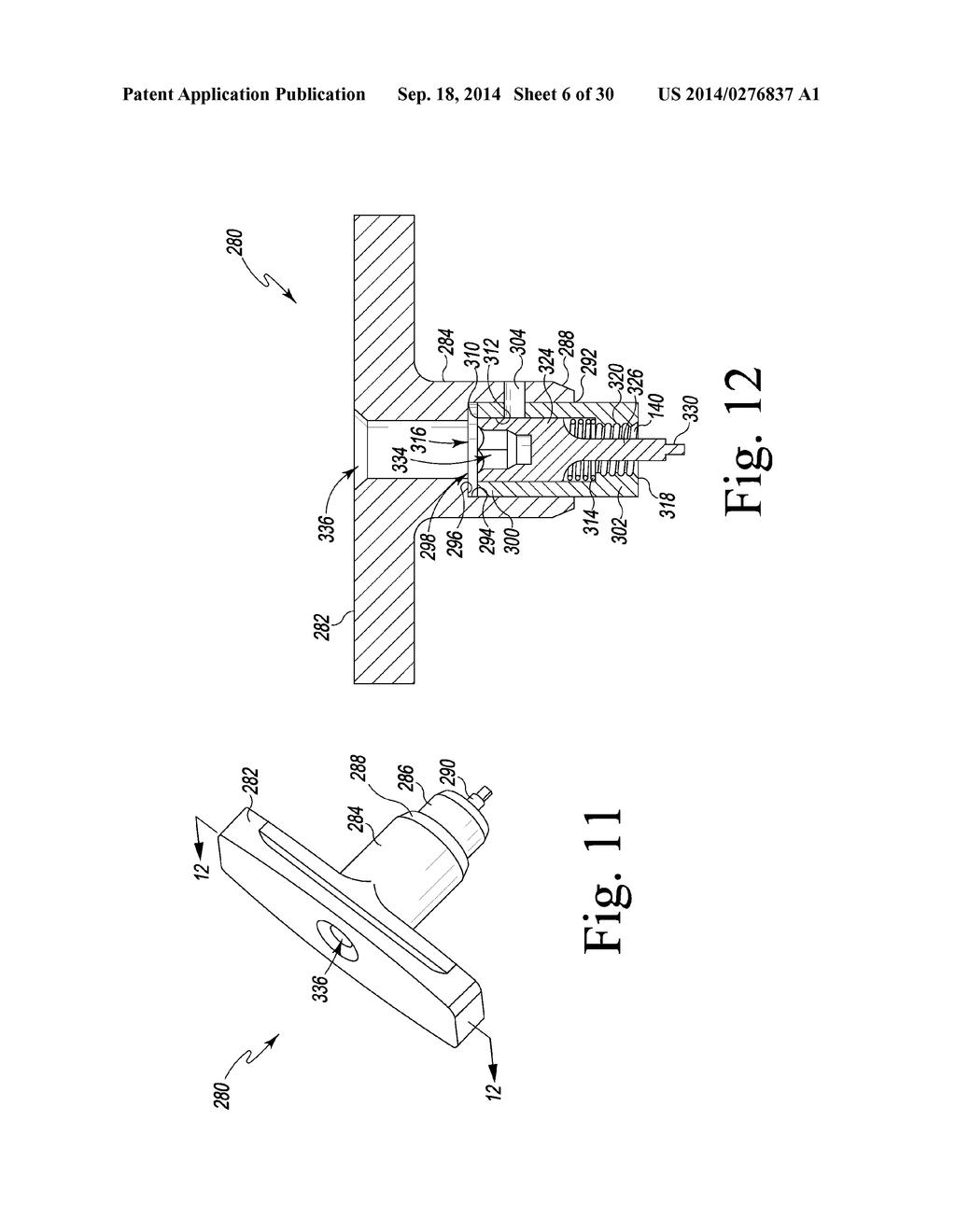 FEMORAL ORTHOPAEDIC INSTRUMENT ASSEMBLY FOR SETTING OFFSET - diagram, schematic, and image 07