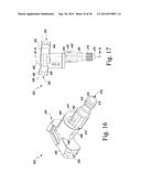 FEMORAL ORTHOPAEDIC INSTRUMENT ASSEMBLY FOR SETTING OFFSET diagram and image