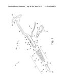 FEMORAL SURGICAL INSTRUMENT AND METHOD OF USING SAME diagram and image