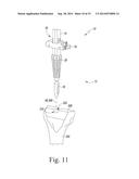 FEMORAL SURGICAL INSTRUMENT AND METHOD OF USING SAME diagram and image