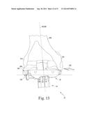 FEMORAL SURGICAL INSTRUMENT AND METHOD OF USING SAME diagram and image