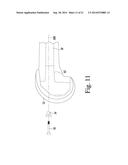 INSTRUMENTS FOR USE IN DISASSEMBLING IMPLANTS diagram and image