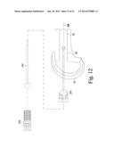 INSTRUMENTS FOR USE IN DISASSEMBLING IMPLANTS diagram and image