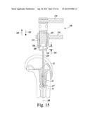 INSTRUMENTS FOR USE IN DISASSEMBLING IMPLANTS diagram and image