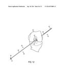 METHODS, SYSTEMS, AND DEVICES FOR GAUGING A BONE TUNNEL diagram and image