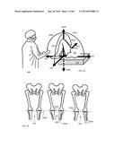 REFERENCE POSITION TOOL FOR THE MUSCULAR-SKELETAL SYSTEM AND METHOD     THEREFOR diagram and image