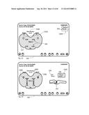 METHOD OF PROVIDING FEEDBACK TO AN ORTHOPEDIC ALIGNMENT SYSTEM diagram and image