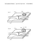 METHOD OF PROVIDING FEEDBACK TO AN ORTHOPEDIC ALIGNMENT SYSTEM diagram and image