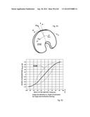 METHOD OF PROVIDING FEEDBACK TO AN ORTHOPEDIC ALIGNMENT SYSTEM diagram and image