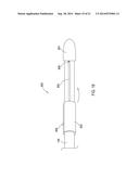 Tools and Methods for Implantation of Implantable Medical Lead Extensions     or Catheters diagram and image