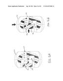 FEATURES TO IMPROVE AND SENSE TYMPANIC MEMBRANE APPOSITION BY TYMPANOSTOMY     TUBE DELIVERY INSTRUMENT diagram and image