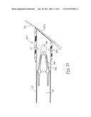 FEATURES TO IMPROVE AND SENSE TYMPANIC MEMBRANE APPOSITION BY TYMPANOSTOMY     TUBE DELIVERY INSTRUMENT diagram and image