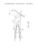 FEATURES TO IMPROVE AND SENSE TYMPANIC MEMBRANE APPOSITION BY TYMPANOSTOMY     TUBE DELIVERY INSTRUMENT diagram and image