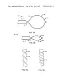 TISSUE RESECTION SNARES diagram and image